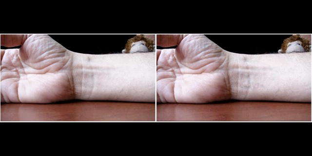 The same wrist side by side: original on the left, pulse-amplified on the right
